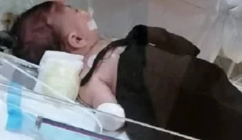 صلاة على الطفل المنذور عند نزع ثوبه